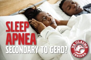 Blog Sleep Apnea Secondary to Gerd min