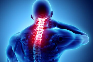 What is the Cervical Strain VA Rating