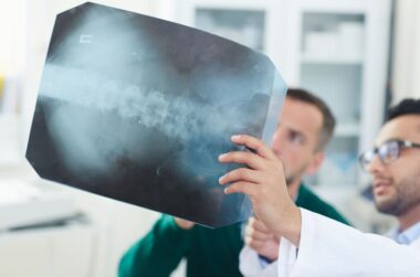 SECONDARY CONDITIONS TO DEGENERATIVE DISC DISEASE