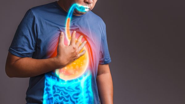 GERD VA Disability Rating Changes