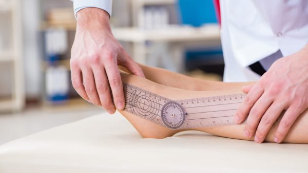 ANKLE VA DISABILITY RATING