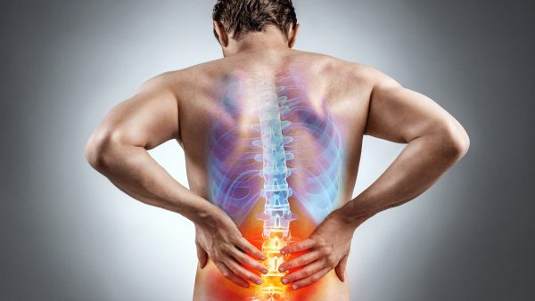 How to Get a VA Disability Rating for Back Problems