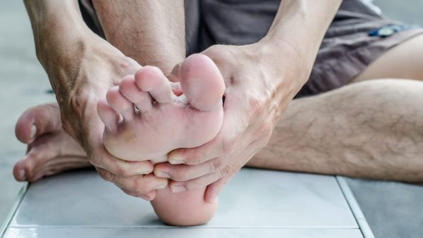 TINEA PEDIS VA RATING
