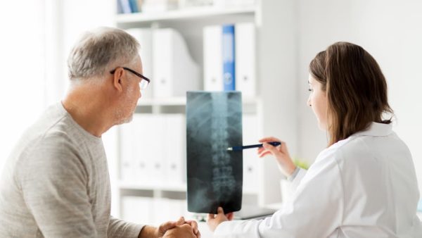 VA RATING FOR SPONDYLOSIS