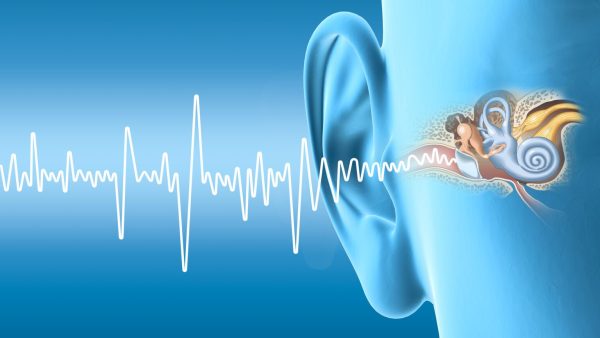 VA Tinnitus C&P Exam