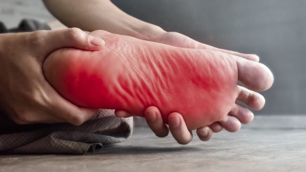 C and P Exam for Peripheral Neuropathy