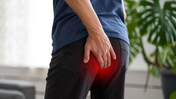 C&P Exam for Hemorrhoids