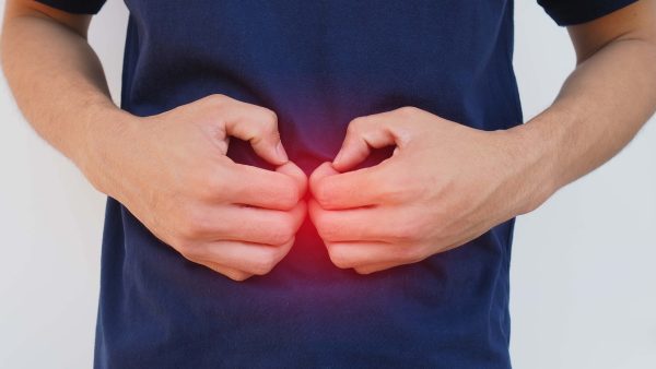 VA Rating for Hiatal Hernia