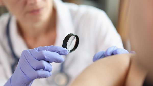 How to Ace Your VA C&P Exam for Skin Conditions