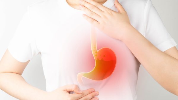 How to Get an 80% VA Rating for GERD